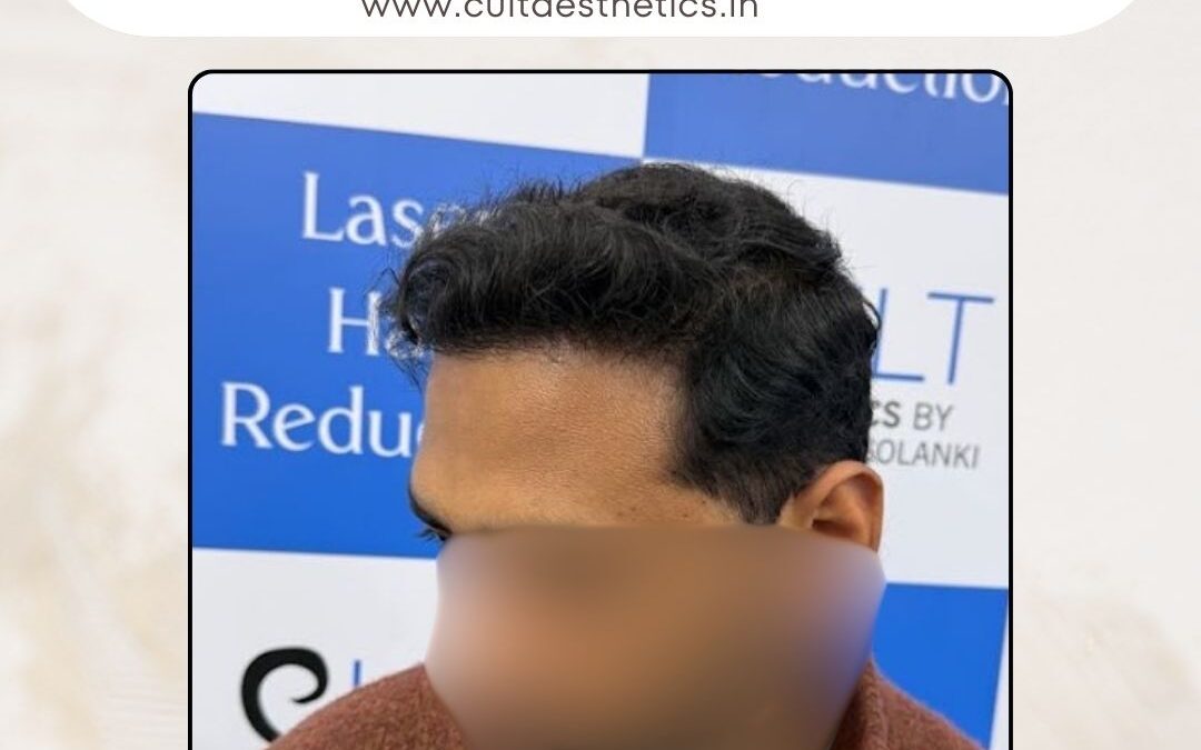 Hair Case 405 After 2