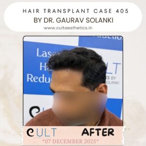 hair case 405 After-2