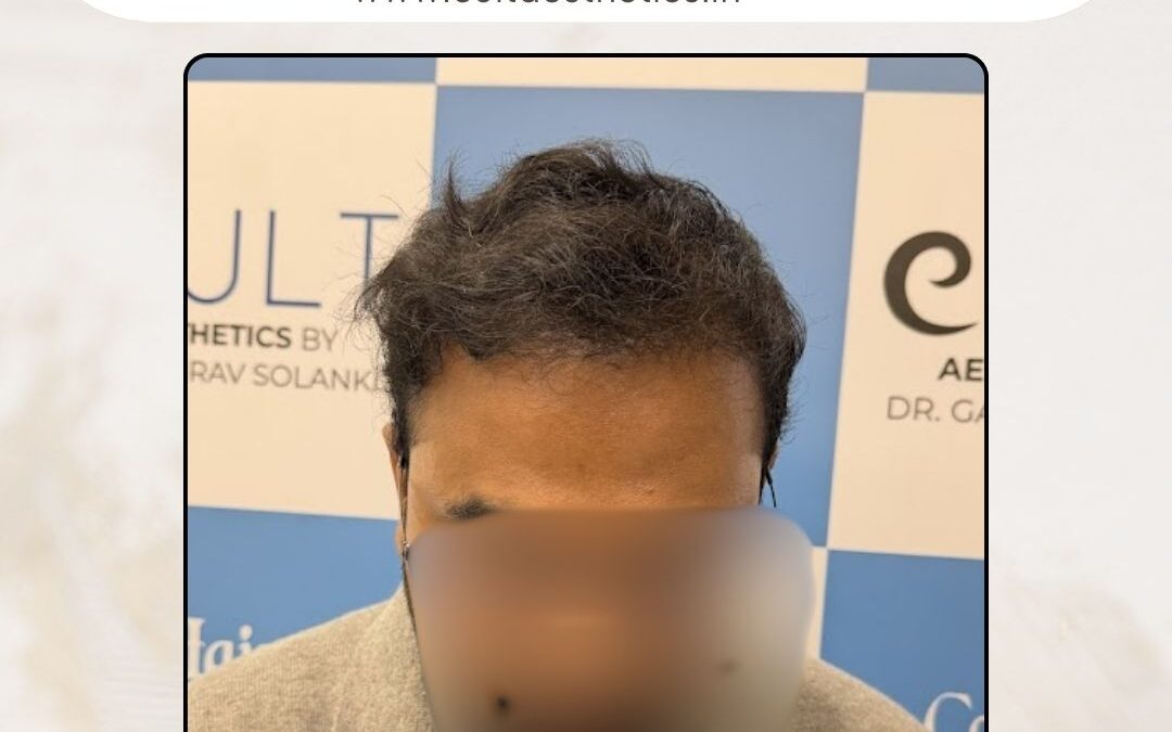 Hair Case 406 After 1