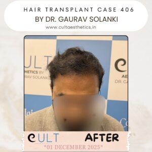 hair case 406 After-1