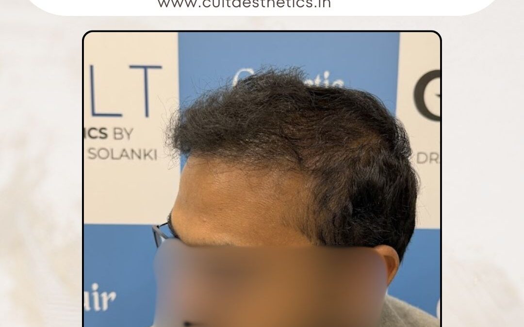 Hair Case 406 After 2