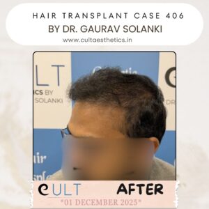 hair case 406 After-2