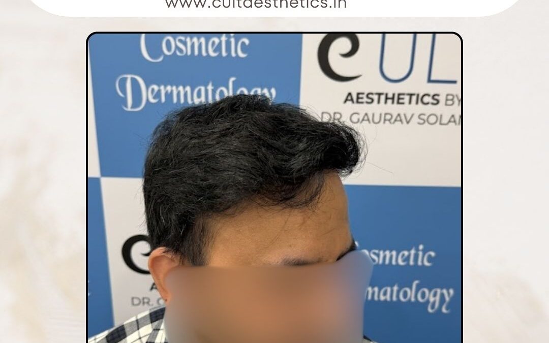 Hair Case 407 After 2