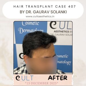 hair case 407 After-2