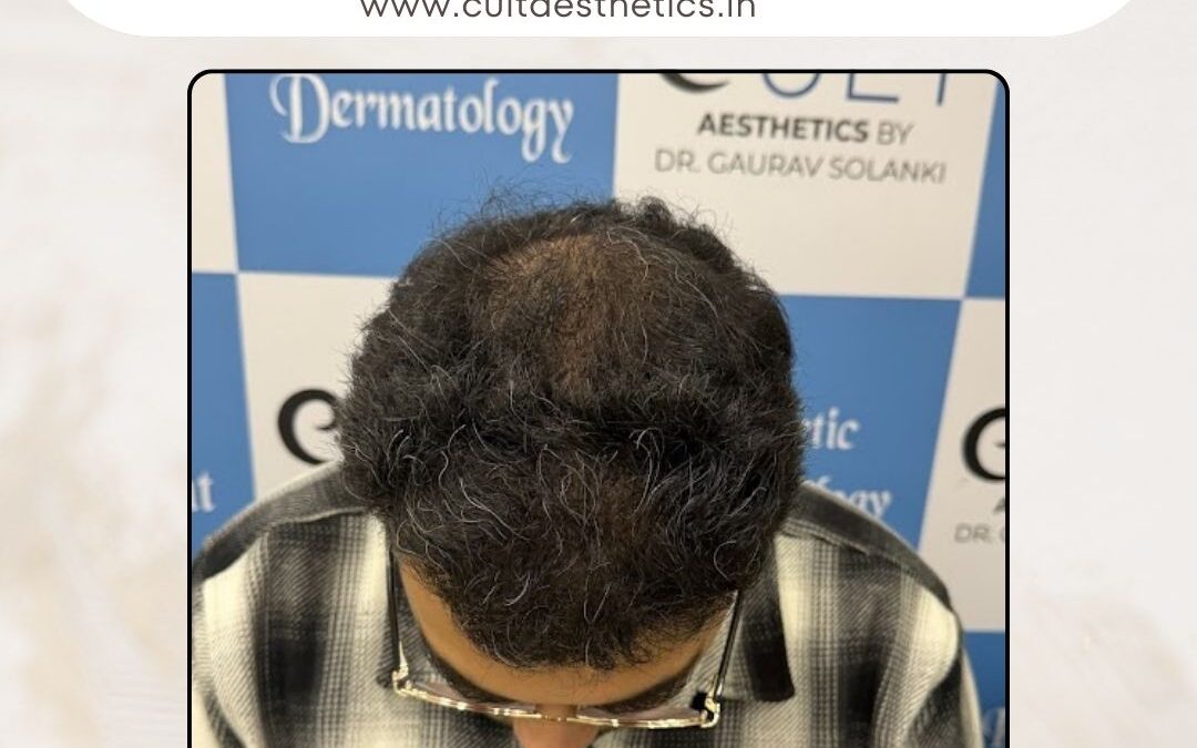 Hair Case 408 After 2