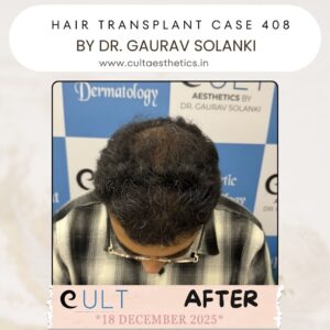 hair case 408 After-2
