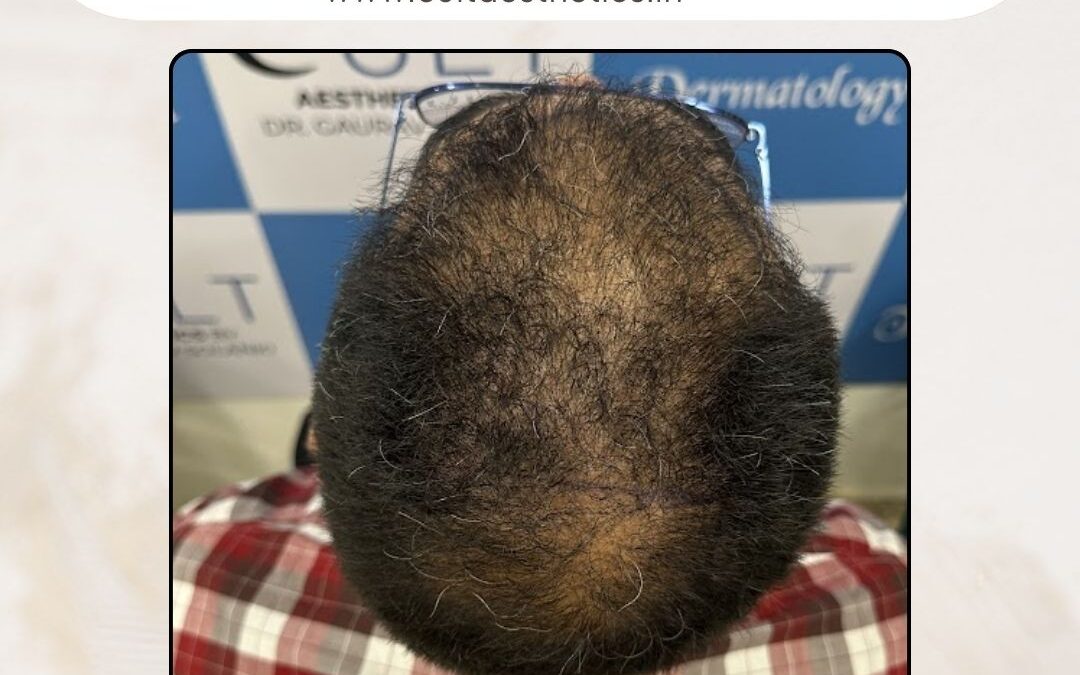 Hair Case 408 Before 3