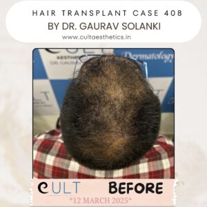 hair case 408 Before-3