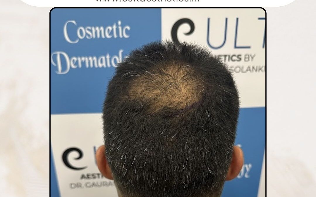 Hair Case 408 Before 4