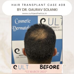 hair case 408 Before-4