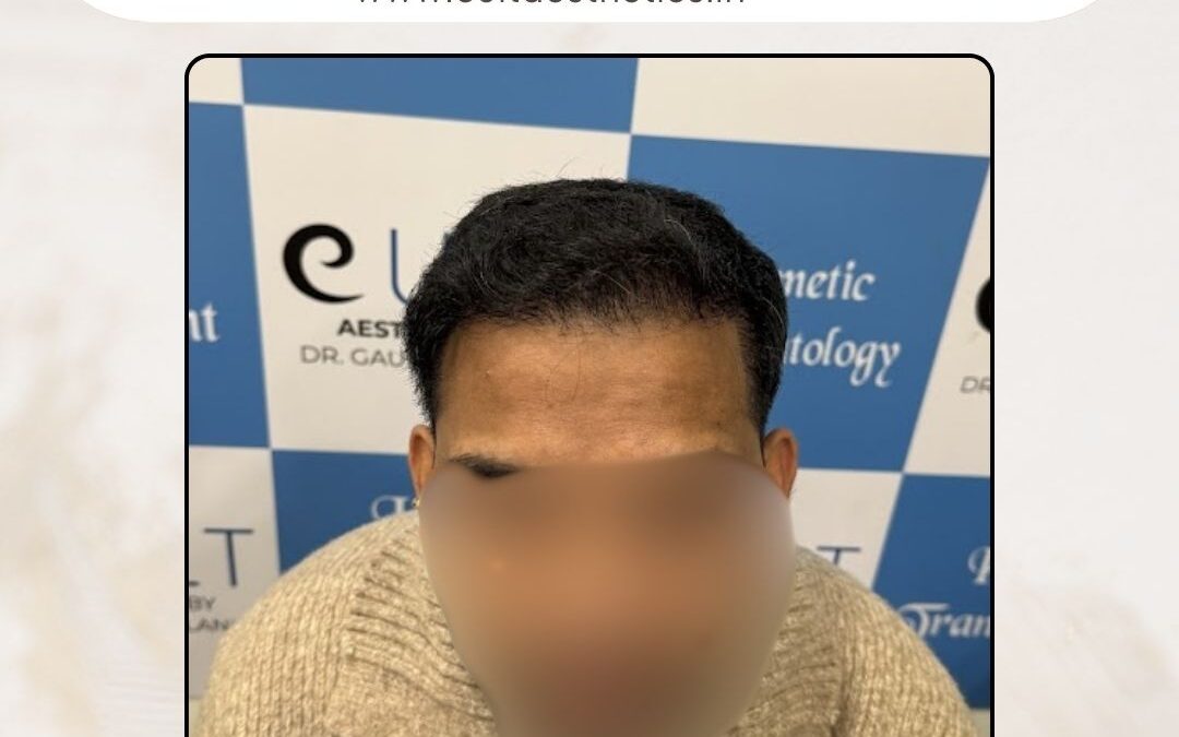 Hair Case 409 After 1