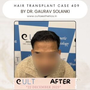 hair case 409 After-1