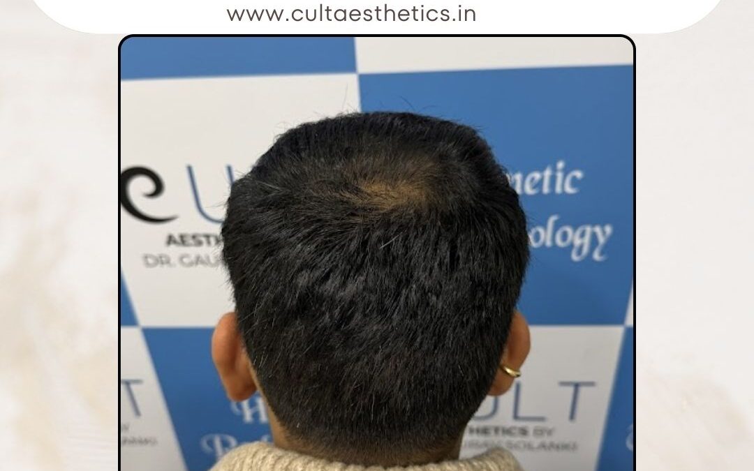 Hair Case 409 After 4