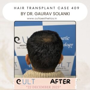 hair case 409 After-4