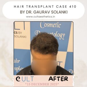 hair case 410 After-2