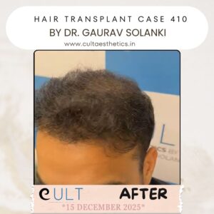 hair case 410 After-3