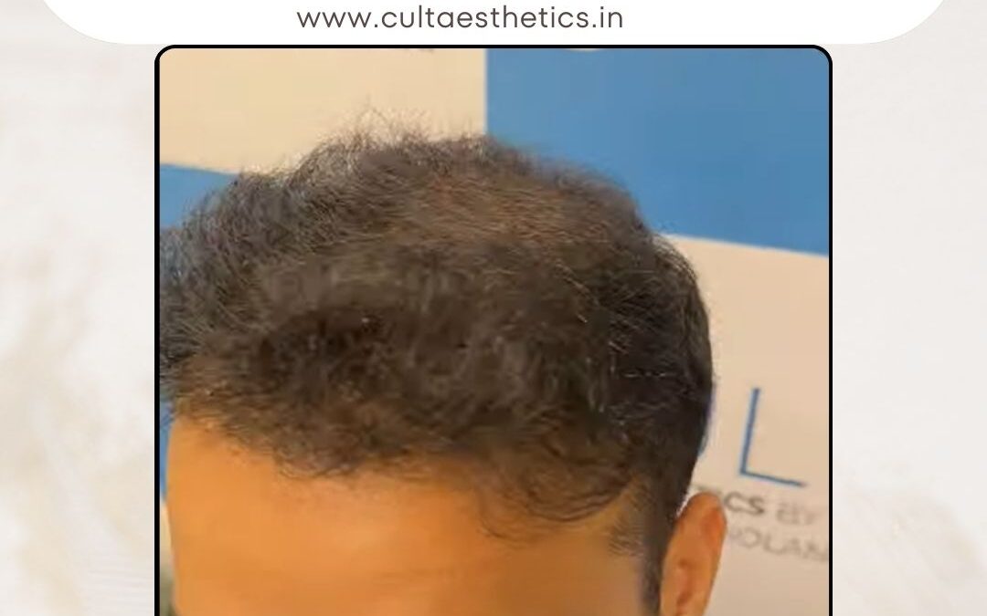 Hair Case 410 After 3