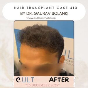 hair case 410 After-4
