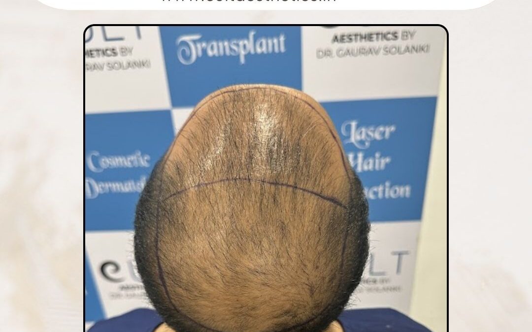 Hair Case 410 Before 3