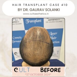 hair case 410 Before-3