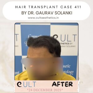 hair case 411 After-2