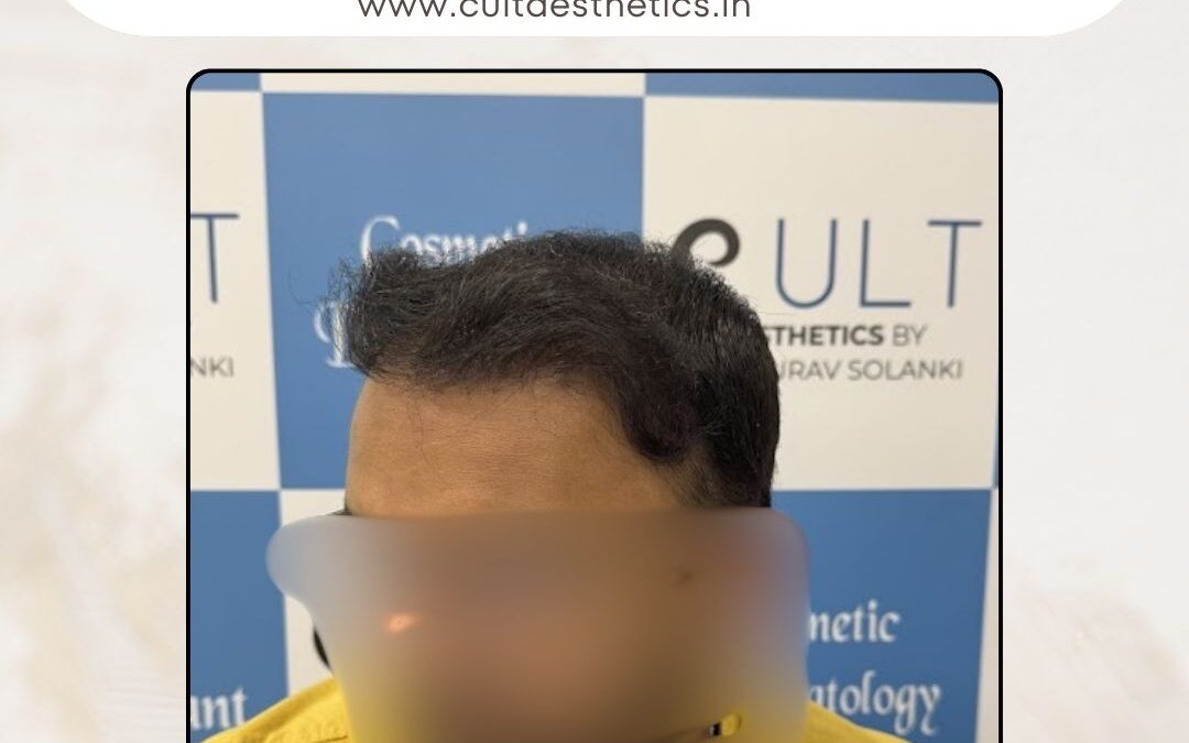 Hair Case 411 After 2