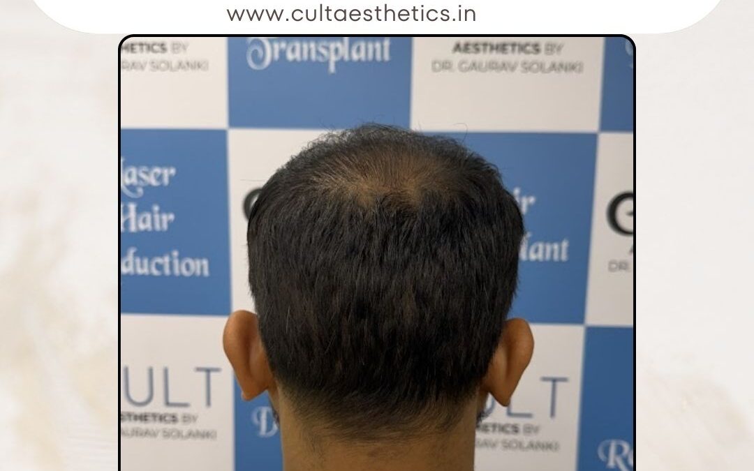 Hair Case 411 After 4