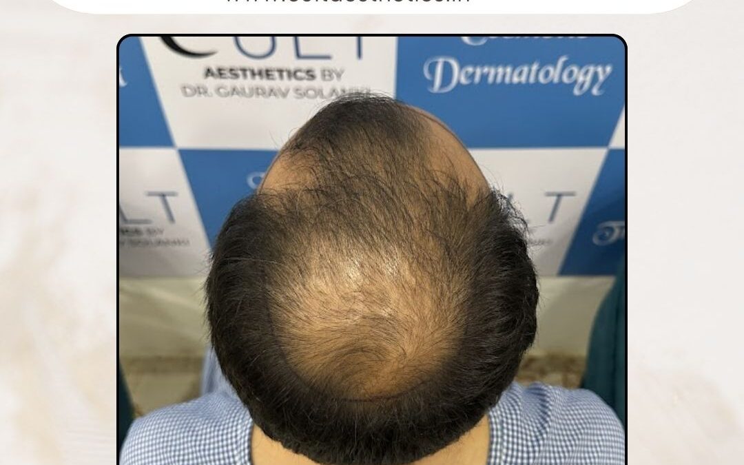 Hair Case 411 Before 3