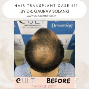 hair case 411 Before-3