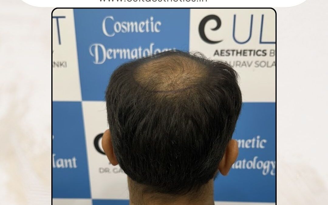 Hair Case 411 Before 4