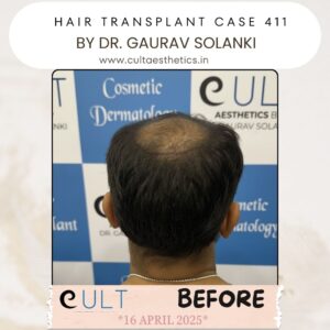 hair case 411 Before-4