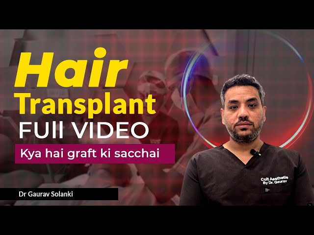 Corrective Hair Transplant Baldness A Real-World Case Study 344