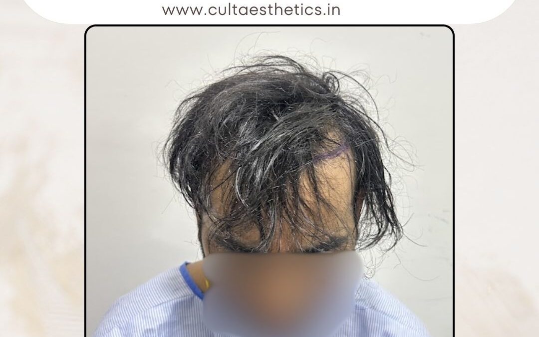 Hair Case 412 Before 1