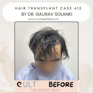 Hair case 412 Before-1