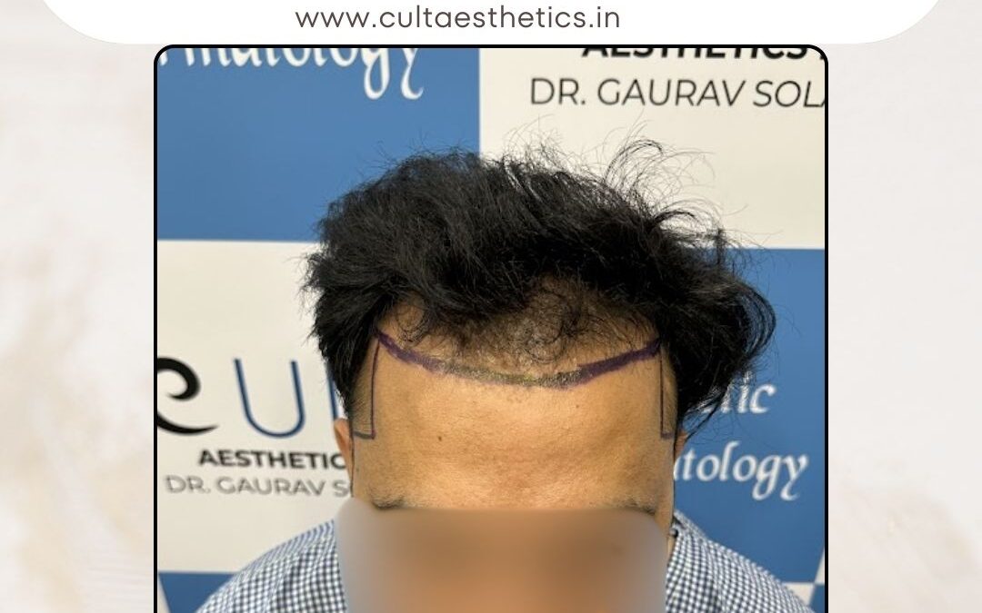 Hair Case 413 Before 1