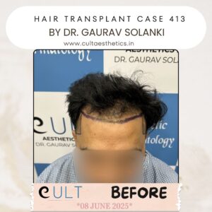 Hair case 413 Before-1