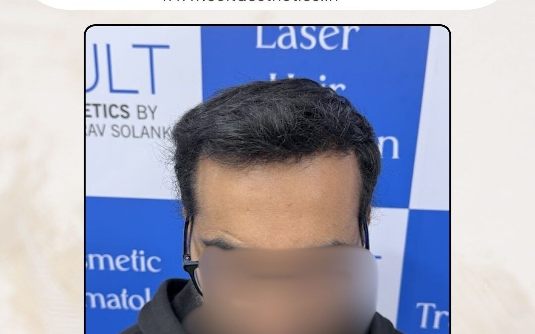 Hair Case 412 After 1