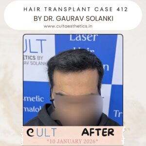 hair case 412 After-1