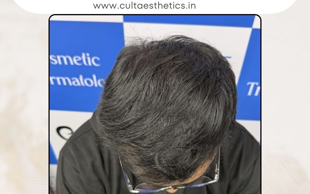 Hair Case 412 After 3
