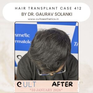 hair case 412 After-3