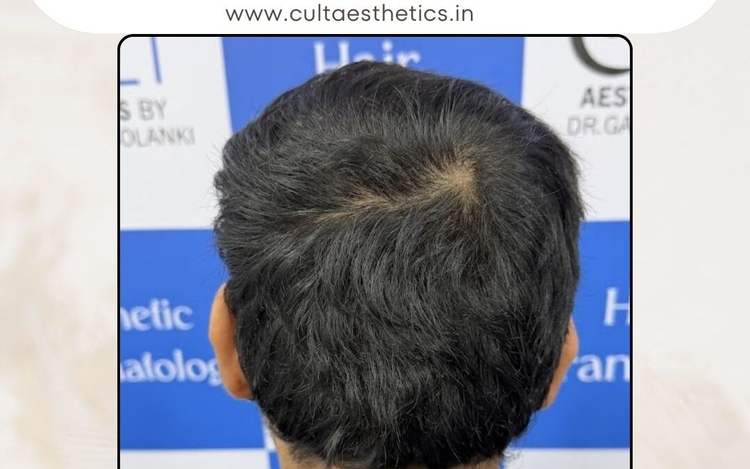 Hair Case 412 After 4