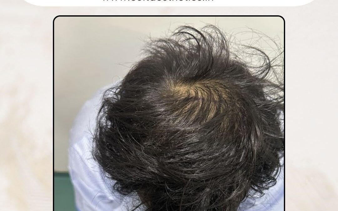 Hair Case 412 Before 3