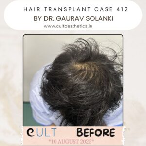 hair case 412 Before-3