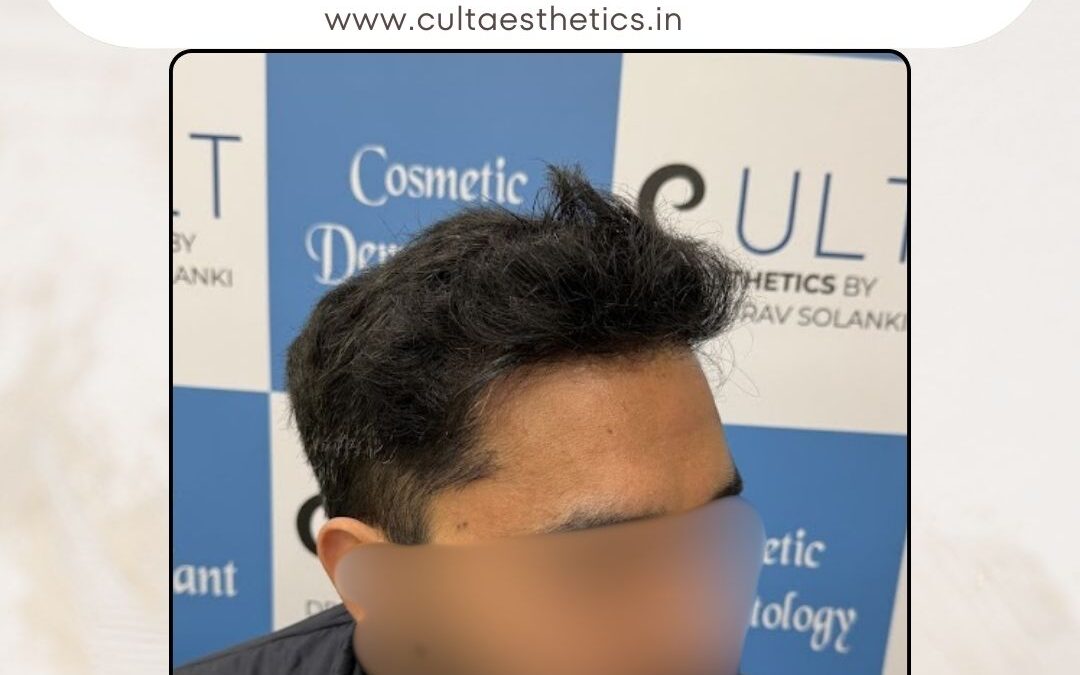 Hair Case 413 After 3