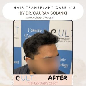 hair case 413 After-3