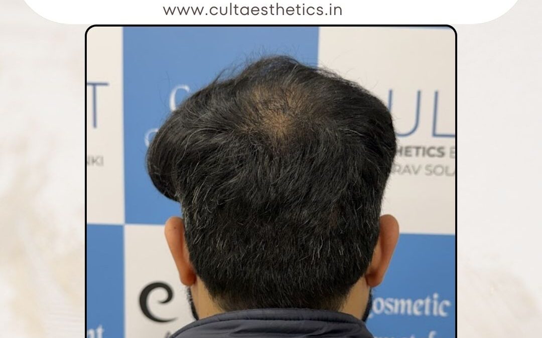 Hair Case 413 After 4
