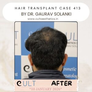 hair case 413 After-4