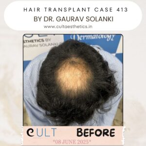 hair case 413 Before-2