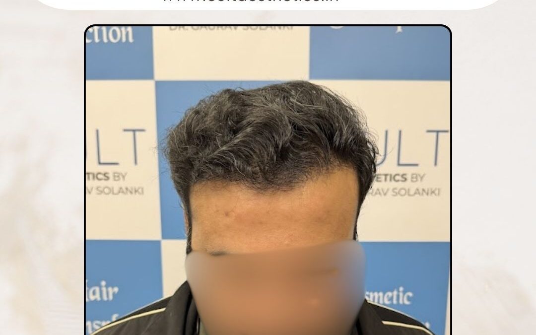 Hair Case 414 After 1