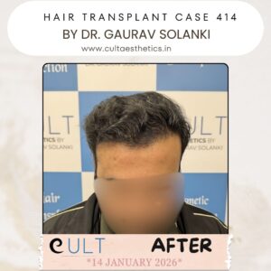 hair case 414 After-1